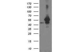 HEK293T cells were transfected with the pCMV6-ENTRY control (Left lane) or pCMV6-ENTRY ARFGAP1 (Right lane) cDNA for 48 hrs and lysed. (ARFGAP1 antibody)