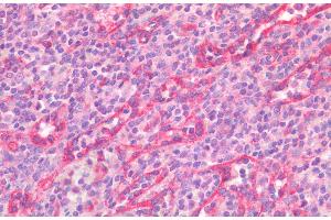 (ABIN5539582) (5 μg/mL) staining of paraffin embedded Human Spleen. (STAT5A antibody  (AA 681-692))