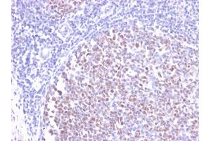 Formalin-fixed, paraffin-embedded human Tonsil stained with BCL-6 Rabbit Recombinant Monoclonal Antibody (BCL6/2497R). (Recombinant BCL6 antibody  (AA 256-389))