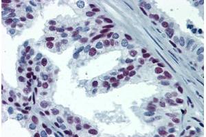 Human Prostate: Formalin-Fixed, Paraffin-Embedded (FFPE) (SP1 antibody  (AA 89-199))
