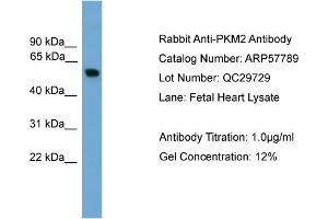 WB Suggested Anti-PKM2  Antibody Titration: 0. (PKM2 antibody  (Middle Region))