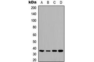 Western blot analysis of TMBIM1 expression in HeLa (A), HepG2 (B), mouse brain (C), rat kidney (D) whole cell lysates. (TMBIM1 antibody  (C-Term))