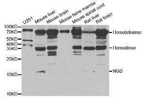 Western blot analysis of extracts of various cell lines, using NGB antibody. (Neuroglobin antibody)