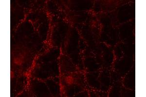 Indirect immunostaining of PFA fixed rat hippocampus neurons (dilution 1 : 500). (TMEM163 antibody  (AA 44-63))