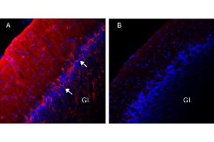anti-Potassium Voltage-Gated Channel, Shaker-Related Subfamily, Member 1 (KCNA1) (1st Extracellular Loop), (AA 193-206) antibody