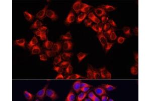Immunofluorescence analysis of HeLa cells using ARHGAP1 Polyclonal Antibody at dilution of 1:100. (ARHGAP1 antibody)