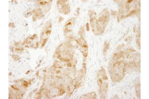 Immunohistochemistry (IHC) image for anti-Ribosomal Protein S6 (RPS6) (C-Term) antibody (ABIN7449016)