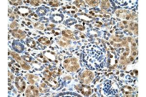 ZNF169 antibody was used for immunohistochemistry at a concentration of 4-8 ug/ml to stain Epithelial cells of renal tubule (arrows) in Human Kidney. (ZNF169 antibody  (Middle Region))