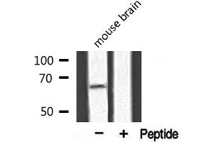 Western blot analysis of extracts from mouse brain, using APPBP2 antibody.
