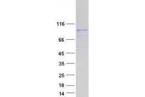 Validation with Western Blot (ATP6V0A4 Protein (Transcript Variant 1) (Myc-DYKDDDDK Tag))