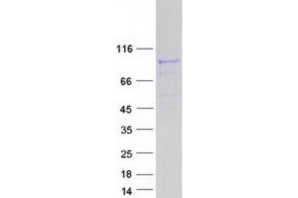 ATP6V0A4 Protein (Transcript Variant 1) (Myc-DYKDDDDK Tag)