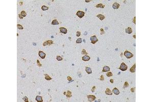 Immunohistochemistry of paraffin-embedded Mouse brain using VEGFC Polyclonal Antibody (VEGFC antibody)