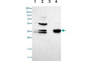 Western blot analysis of Lane 1: Human cell line RT-4, Lane 2: Human cell line U-251MG sp, Lane 3: Human plasma (IgG/HSA depleted), Lane 4: Human liver tissue with CGRRF1 polyclonal antibody  at 1:100-1:250 dilution.