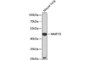 Western blot analysis of extracts of Mouse lung using MMP19 Polyclonal Antibody at dilution of 1:1000. (MMP19 antibody)