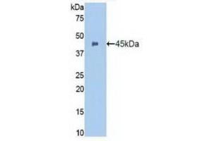 Detection of Recombinant ITGaM, Human using Polyclonal Antibody to Integrin Alpha M (CD11b) (CD11b antibody  (AA 301-451))