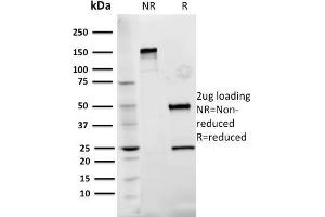 SDS-PAGE Analysis Purified Fibronectin Mouse Monoclonal Antibody (Fn-3). (Fibronectin 1 antibody)