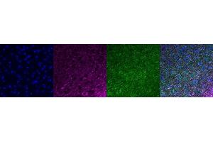 Immunohistochemistry (IHC) image for anti-Microtubule-Associated Protein 2 (MAP2) antibody (ABIN7456240) (MAP2 antibody)
