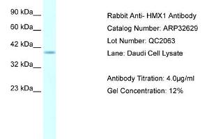 Human Daudi; WB Suggested Anti-HMX1 AntibodyTitration: 4. (HMX1 antibody  (Middle Region))