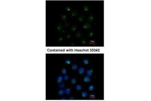 ICC/IF Image Immunofluorescence analysis of methanol-fixed A431, using SAR1A, antibody at 1:500 dilution. (SAR1A antibody  (Center))
