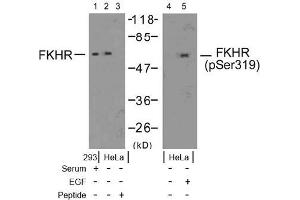 Image no. 2 for anti-Forkhead Box O1 (FOXO1) (pSer319) antibody (ABIN196849) (FOXO1 antibody  (pSer319))