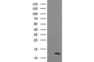 Image no. 1 for anti-D-Dopachrome Tautomerase (DDT) antibody (ABIN1497794) (DDT antibody)
