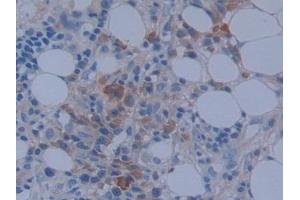 Used in DAB staining on fromalin fixed paraffin- embedded stomach tissue (MACC1 antibody  (AA 522-784))