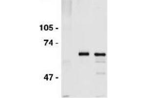 Western Blotting (WB) image for anti-Cell Division Cycle 6 Homolog (S. Cerevisiae) (CDC6) (AA 1-326) antibody (ABIN2451939)
