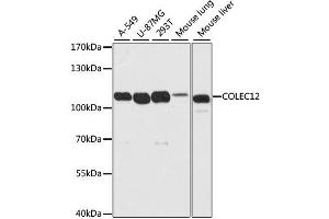 Western blot analysis of extracts of various cell lines, using COLEC12 antibody. (COLEC12 antibody  (AA 60-270))