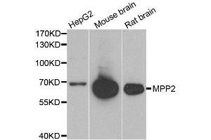 Western blot analysis of extracts of various cell lines, using MPP2 antibody.