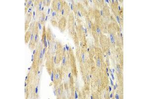 Immunohistochemistry of paraffin-embedded mouse heart using KRT19 antibody (ABIN5970077) at dilution of 1/100 (40x lens).