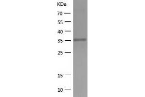 Western Blotting (WB) image for 3-hydroxyisobutyryl-CoA Hydrolase (HIBCH) (AA 33-386) protein (His tag) (ABIN7287644) (HIBCH Protein (AA 33-386) (His tag))
