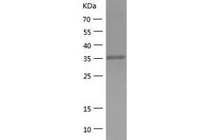 HIBCH Protein (AA 33-386) (His tag)