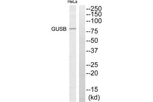 Western Blotting (WB) image for anti-Glucuronidase, beta (GUSB) (Internal Region) antibody (ABIN1850919) (Glucuronidase beta antibody  (Internal Region))