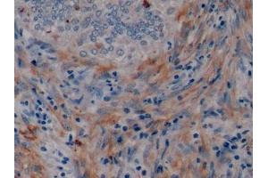 Immunohistochemistry (IHC) image for anti-Mucin 1 (MUC1) (AA 1098-1255) antibody (ABIN7429043)