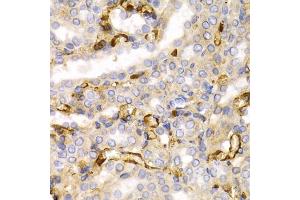 Immunohistochemistry of paraffin-embedded rat kidney using NEFL antibody. (NEFL antibody)