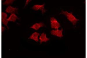 ABIN6275559 staining HuvEc by IF/ICC. (SHB antibody  (C-Term))