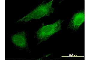 Immunofluorescence of monoclonal antibody to FAIM2 on HeLa cell. (FAIM2 antibody  (AA 1-316))