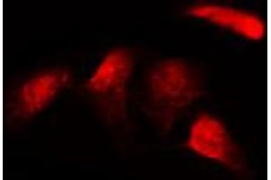 ABIN6269311 staining HepG2 by IF/ICC. (RELB antibody  (C-Term))