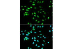 Immunofluorescence analysis of MCF7 cell using PAX3 antibody. (Paired Box 3 antibody  (AA 1-206))