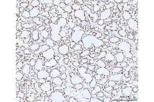 IHC analysis of HMGN2 using anti-HMGN2 antibody (ABIN6719576). (HMGN2 antibody)