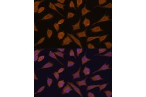 Immunofluorescence analysis of L929 cells using 43711 antibody (ABIN7270204) at dilution of 1:100. (Septin 3 antibody  (AA 179-358))