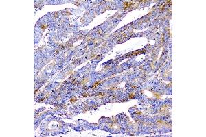 IHC analysis of CD2AP using anti-CD2AP antibody (ABIN6719544).