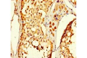 Immunohistochemistry of paraffin-embedded human testis tissue using ABIN7175061 at dilution of 1:100 (C5orf51 antibody  (AA 8-152))