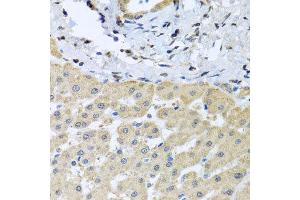 Immunohistochemistry of paraffin-embedded human liver injury using LETMD1 antibody at dilution of 1:100 (x40 lens). (LETMD1 antibody)