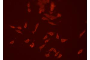 ABIN6266634 staining HEPG2 cells by ICC/IF. (SIRPA antibody  (C-Term))