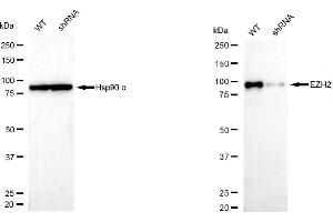 anti-Enhancer of Zeste Homolog 2 (EZH2) antibody