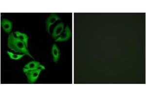 Immunofluorescence analysis of A549 cells, using ADCK4 Antibody. (ADCK4 antibody  (AA 31-80))