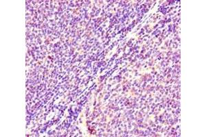 Immunohistochemistry of paraffin-embedded human lymphoid tissue using ABIN7178885 at dilution of 1:100 (HRAS antibody  (AA 2-186))