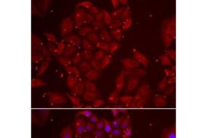 Immunofluorescence analysis of U2OS cells using TPP2 Polyclonal Antibody (Tpp2 antibody)