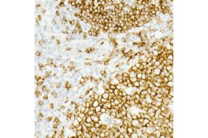 Immunohistochemistry of paraffin-embedded Human tonsil using CD19 antibody (ABIN7266169) at dilution of 1:10000 (40x lens). (CD19 antibody)